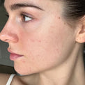 <strong>Rachel P</strong>